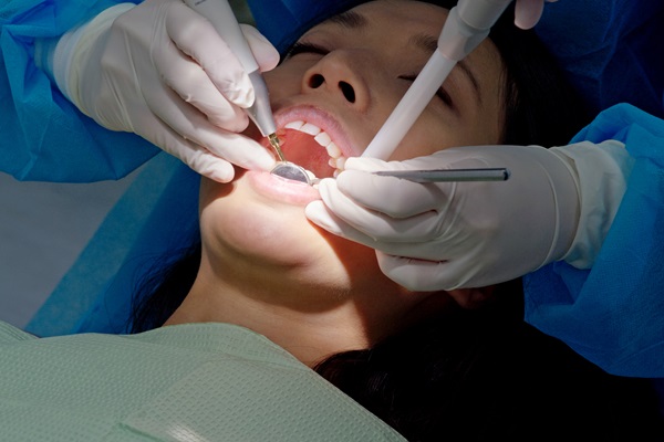 When A Deep Teeth Cleaning Is Recommended For Periodontal Health